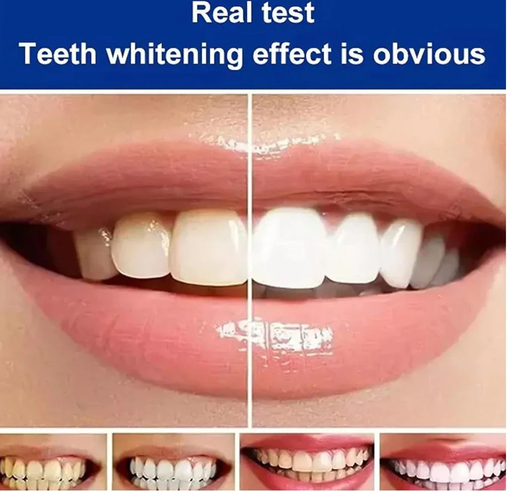 Sp-4 Toothpaste (120g)